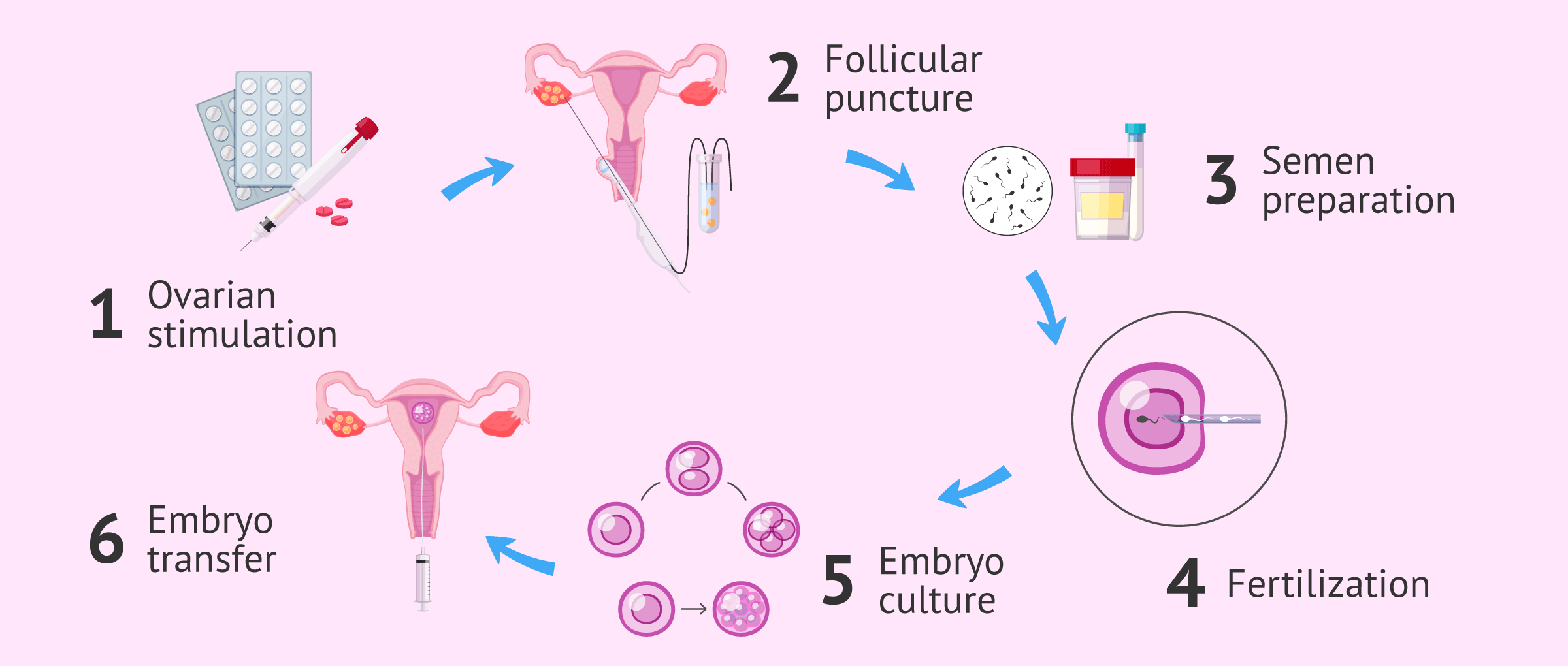 in vitro fertilization process